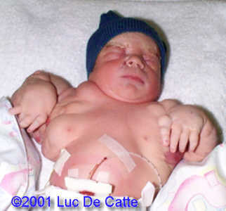 case0043-11