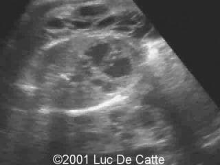 case0043-7