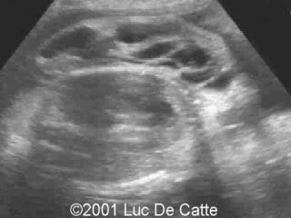 case0043-9