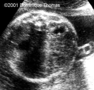 case0044-3