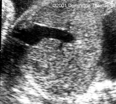 case0044-6