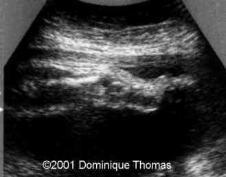 case0044-7