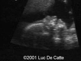 case0045-1