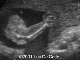 case0045-16