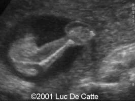 case0045-17