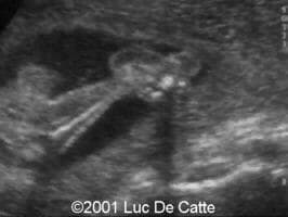 case0045-19