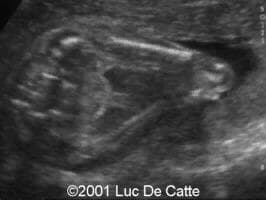 case0045-20