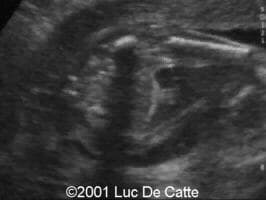 case0045-26
