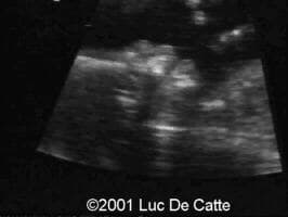 case0045-6