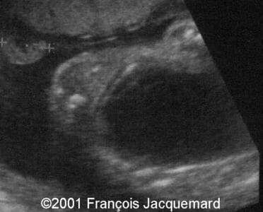 case0046-10