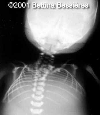 case0046-12