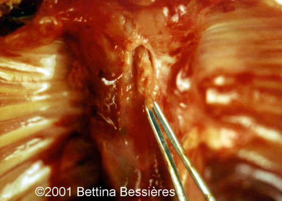 case0046-14