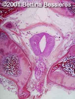 case0046-16