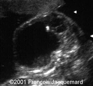 case0046-2
