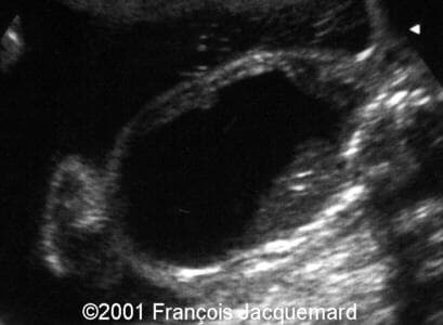 case0046-3