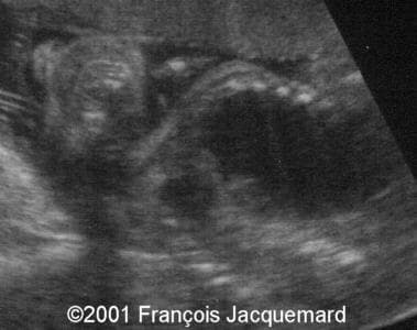 case0046-6