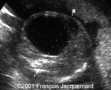 case0046-7