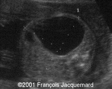 case0046-8