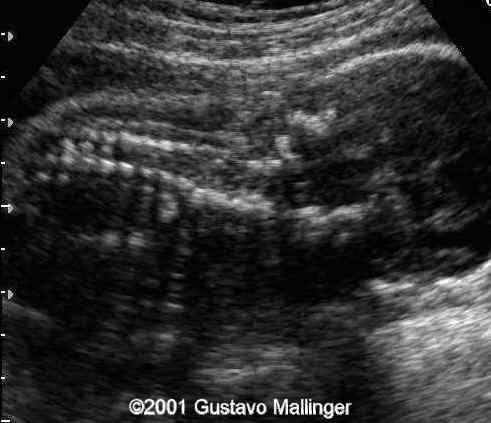 case0049-1