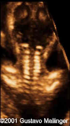 case0049-10