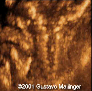 case0049-11