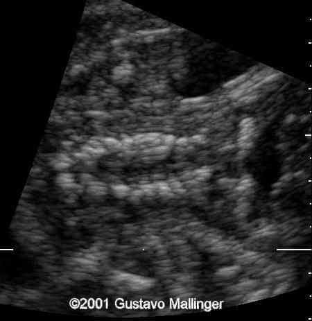 case0049-3