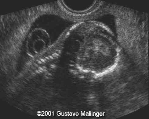 case0049-4