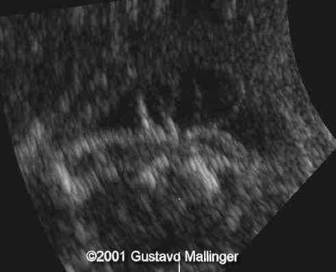 case0049-5