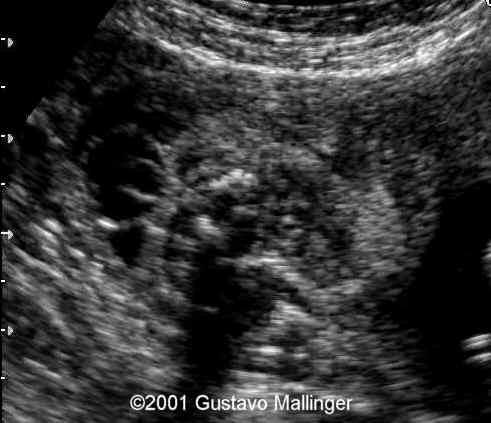 case0049-6