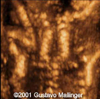 case0049-7