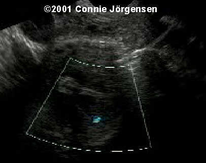 case0050-3
