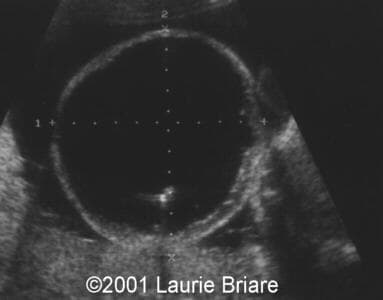 case0051-1