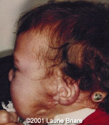 case0051-12