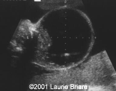 case0051-2