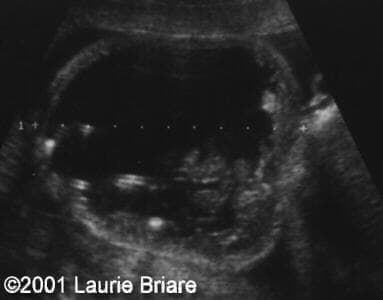 case0051-3