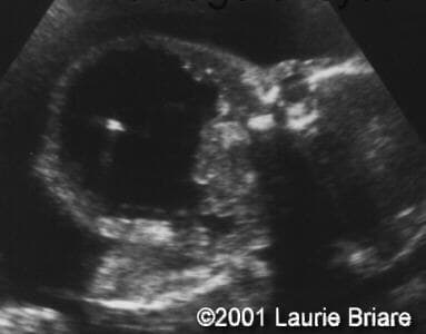 case0051-4