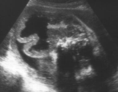 case0051-5