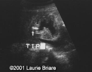 case0051-6