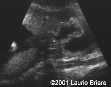 case0051-7