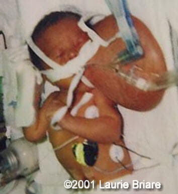 case0051-8