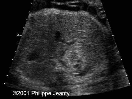 case0054_2