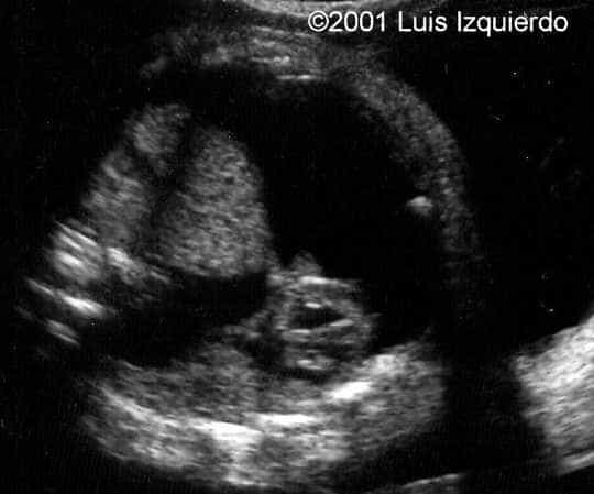 case0055-1