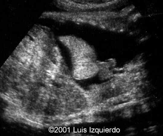 case0055-3