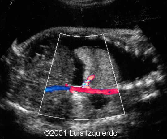 case0055-4