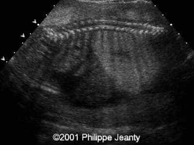 Case0056-3