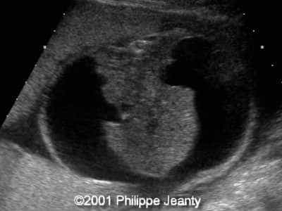 Case0056-4