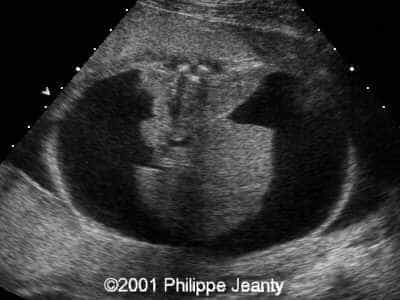 Case0056-5