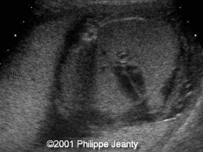 Case0056-7
