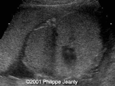 Case0056-8