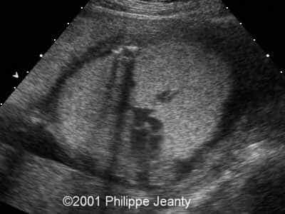 Case0056-9